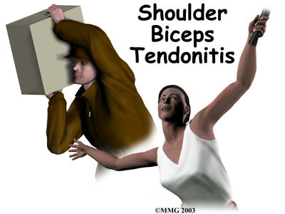 tendonitis, quilting, health